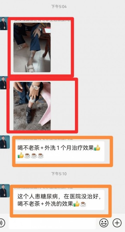 特别报道全球影响力人物成就奖·  2025最美奋斗者·特效醫術傅承人——黄良强