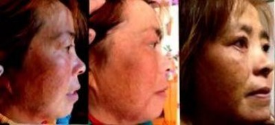 回归本源，让疤痕收回本该易防易治的本来形象！  去除疤痕——几千年做错了这一件事  排毒养疤——让疤痕还回了本容易康复的事情