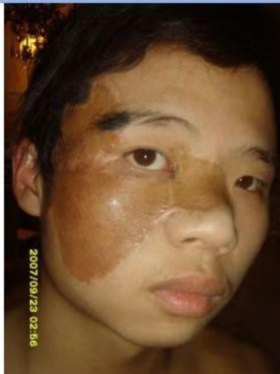 回归本源，让疤痕收回本该易防易治的本来形象！  去除疤痕——几千年做错了这一件事  排毒养疤——让疤痕还回了本容易康复的事情