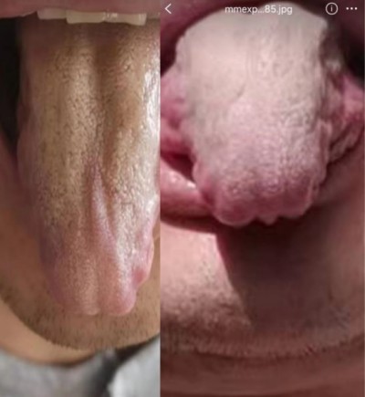 两会重点推荐  心令寿内经养生坊，破解渐冻症世界难题——白海军