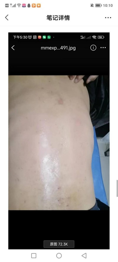 两会重点推荐  心令寿内经养生坊，破解渐冻症世界难题——白海军