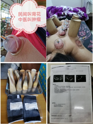 岐黄薪火：蓝信全的中医传承实践与创新研究