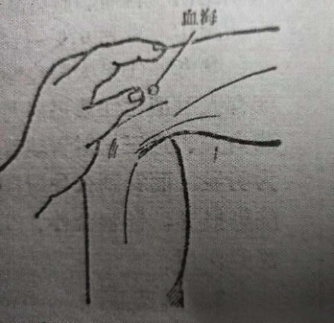 聚焦两会·中医药传承创新：韩礼医师以经方智慧守护人民健康