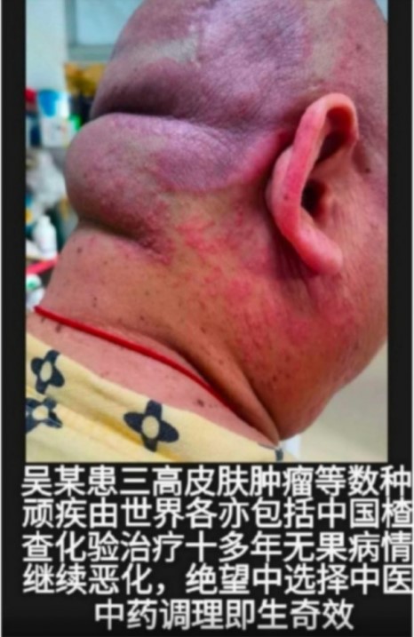 现代医疗手段与古代中医文化》