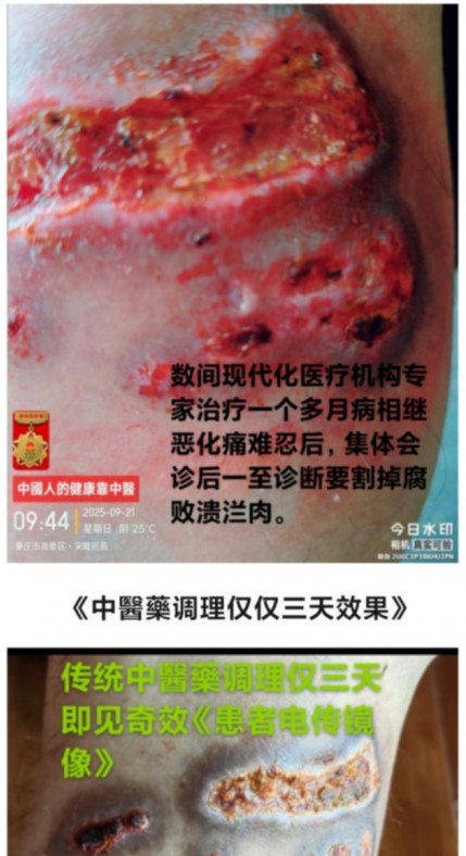 现代医疗手段与古代中医文化》