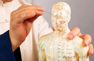 癌症!针灸疗法特效
