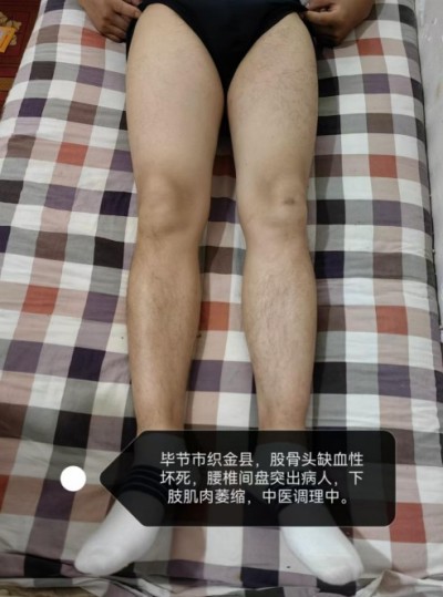 全国两会重点推荐 著名贵州名医---王家贵