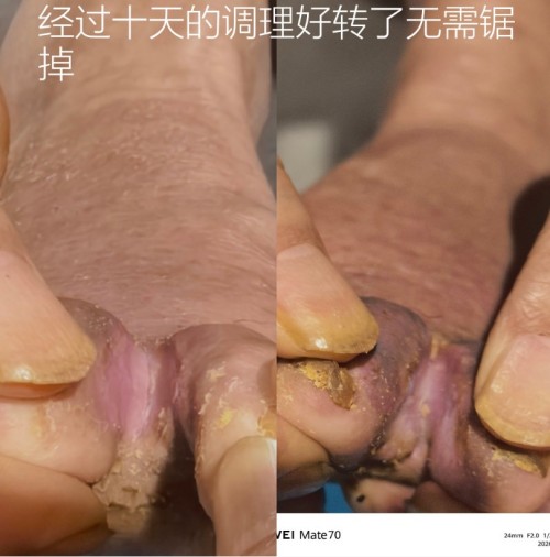 51特别报道：医路深耕五十载 仁心妙手守健康——记资深中医专家杨宗仙