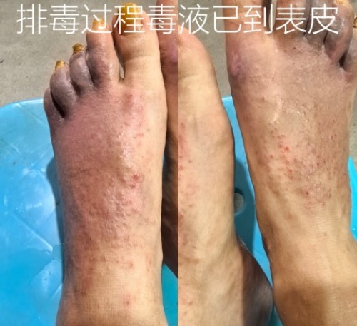 51特别报道：医路深耕五十载 仁心妙手守健康——记资深中医专家杨宗仙